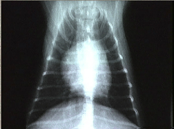 x-ray